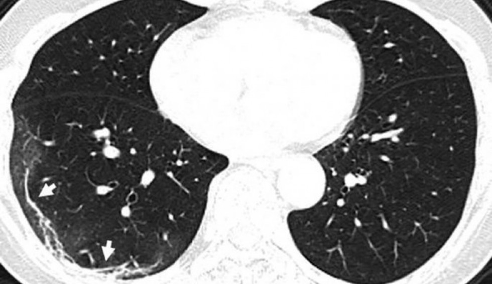 A generic square placeholder image with rounded corners in a figure.