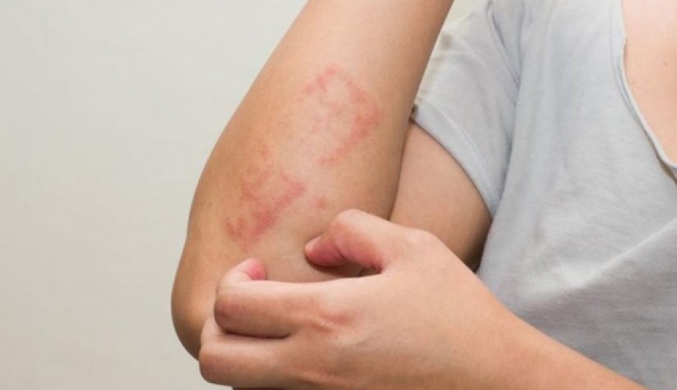 A generic square placeholder image with rounded corners in a figure.