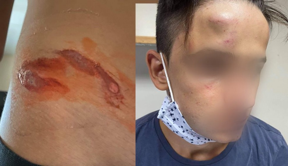 A generic square placeholder image with rounded corners in a figure.