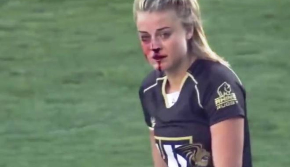 A generic square placeholder image with rounded corners in a figure.