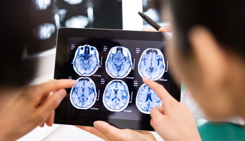 A generic square placeholder image with rounded corners in a figure.