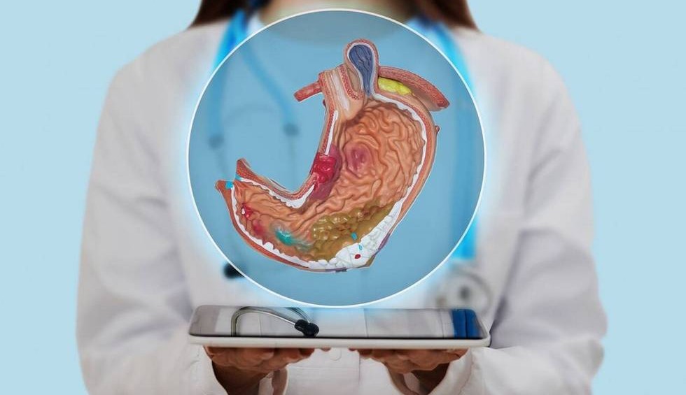 A generic square placeholder image with rounded corners in a figure.