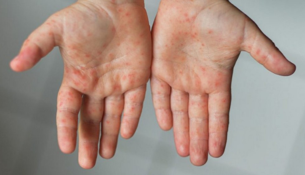 A generic square placeholder image with rounded corners in a figure.