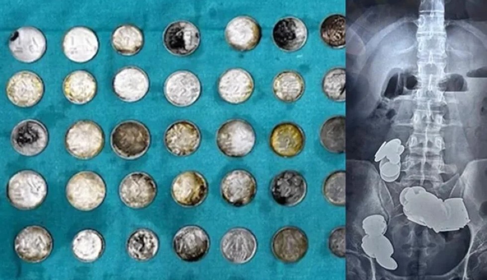 A generic square placeholder image with rounded corners in a figure.