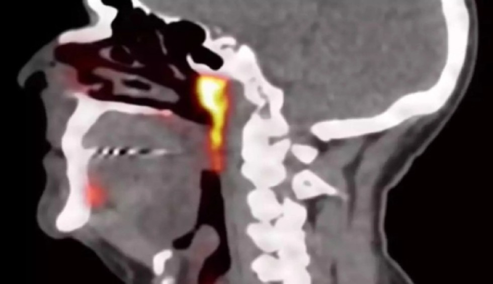 A generic square placeholder image with rounded corners in a figure.