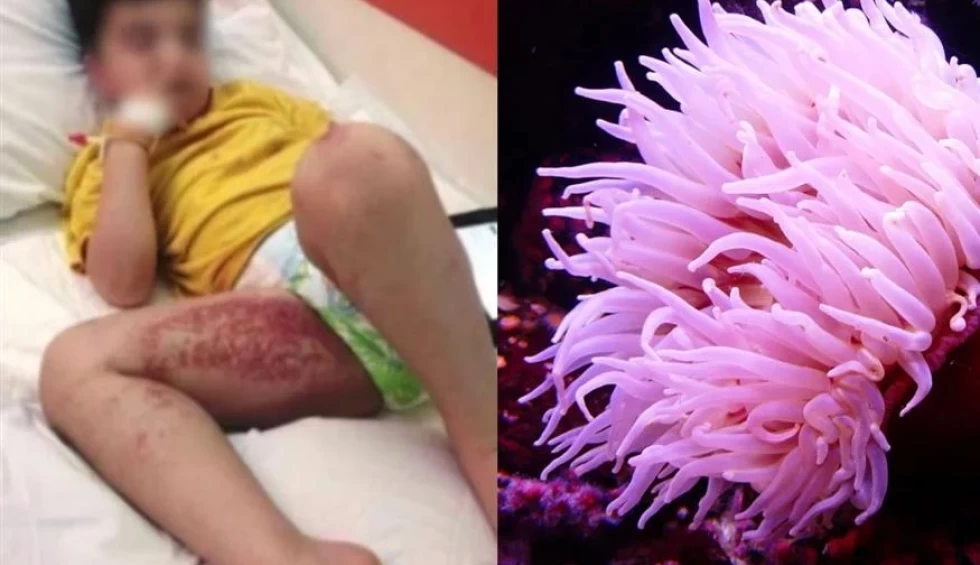 A generic square placeholder image with rounded corners in a figure.