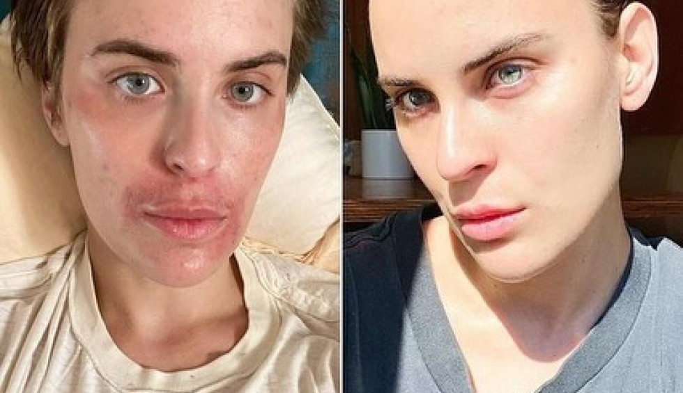 A generic square placeholder image with rounded corners in a figure.