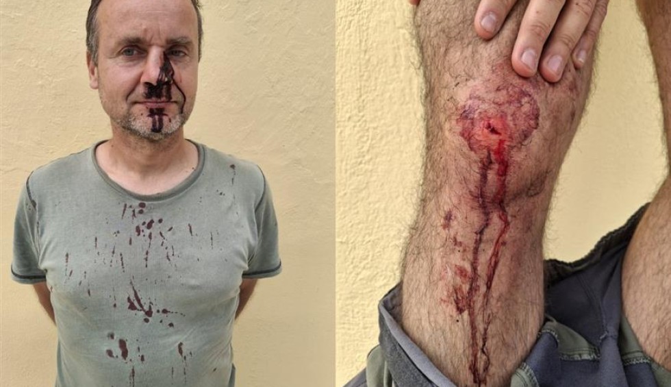 A generic square placeholder image with rounded corners in a figure.