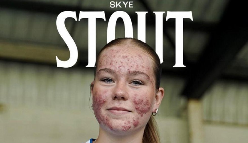 A generic square placeholder image with rounded corners in a figure.