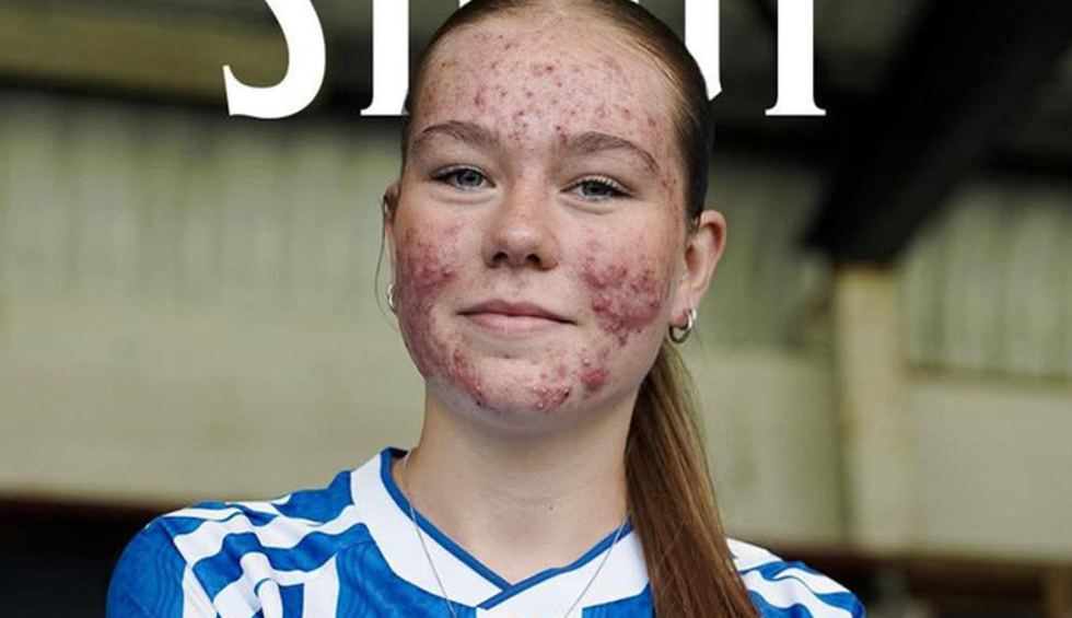 A generic square placeholder image with rounded corners in a figure.