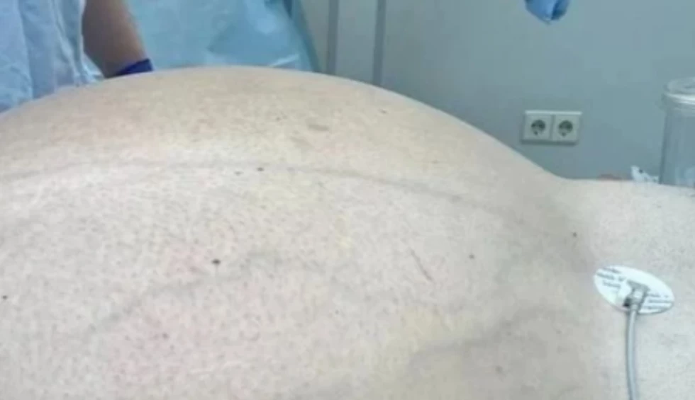 A generic square placeholder image with rounded corners in a figure.