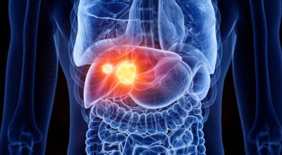 Ο «αόρατος» εχθρός του ήπατος-Οι επιπτώσεις για την υγεία μας