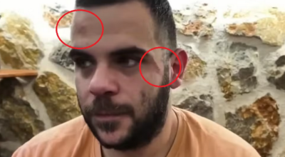 Ξυλοδαρμός YouTuber εν ώρα live στα Ιωάννινα