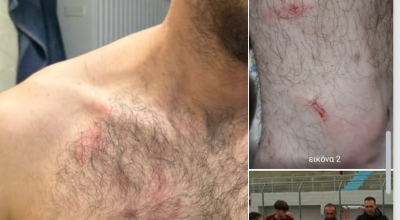 Κιλκισιακός: «Ντράπηκε και η ντροπή»